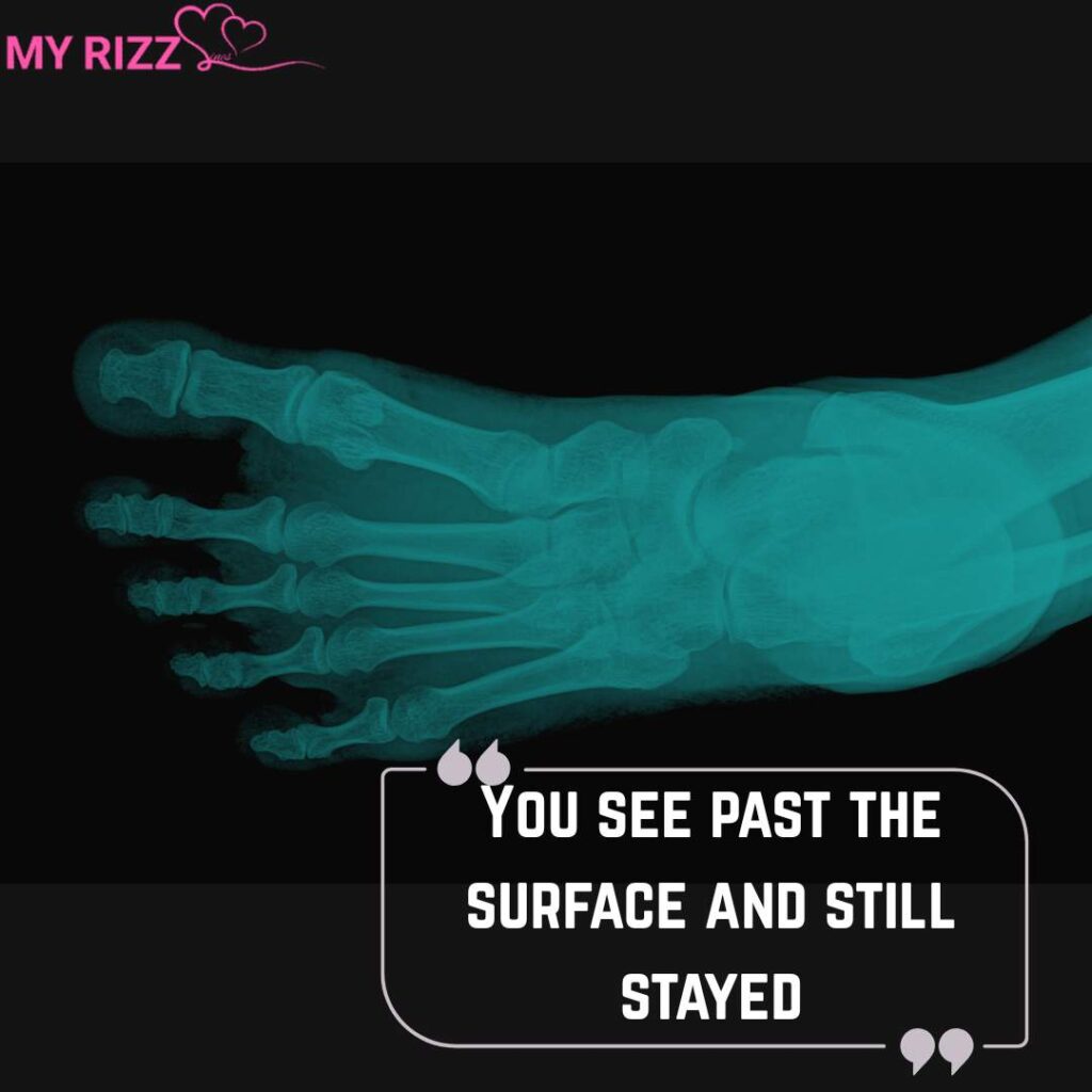 X Ray Rizz Lines